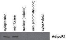 The Adiponectin Receptor 1 Antibody (Cat. No. 250476) is used in Western blot to detect Adiponectin Receptor 1 in human renal cell carcinoma ccRCC 786-O cell lysates. From Duivenvoorden W. et al. 2014.