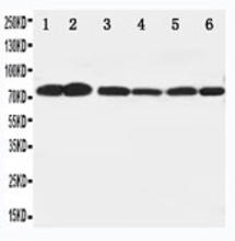 The BRAF Antibody (Cat. No. 251460) is used in Western blot to detect BRAF in rat brain (1), testis (2) and liver (3) tissue lysates as well as SW620 (4), COLO320 (5) and PC12 (6) cell lysates.