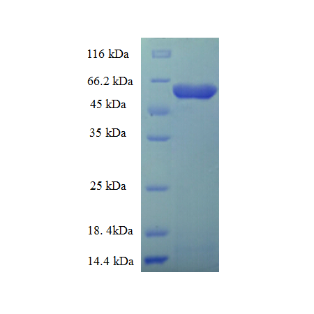 Protein SDS-PAGE