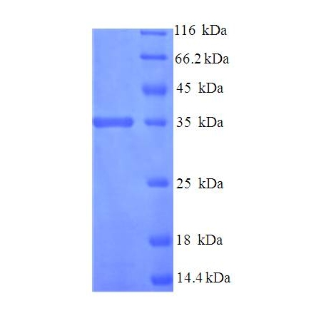 Protein SDS-PAGE
