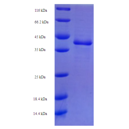 Protein SDS-PAGE