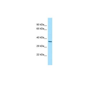 Human 293T
