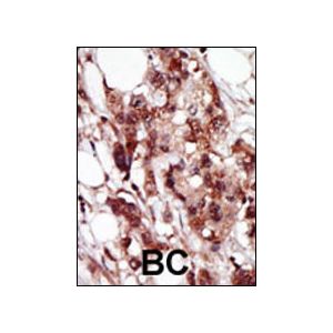 Human Breast