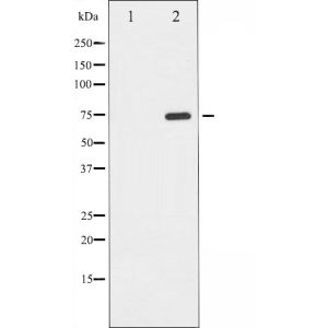 K562 whole cell lysates