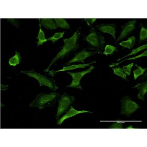 HeLa cell