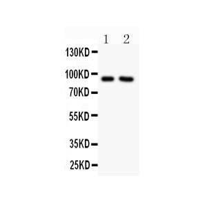 PC-12 Whole Cell Lysate, MCF-7 Whole Cell Lysate