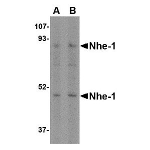Rat Kidney