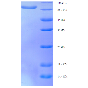 Protein SDS-PAGE