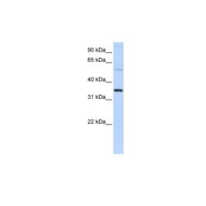 Transfected 293T
