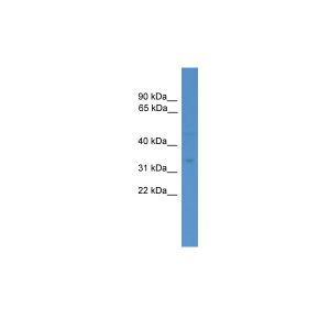 Human NCI-H226