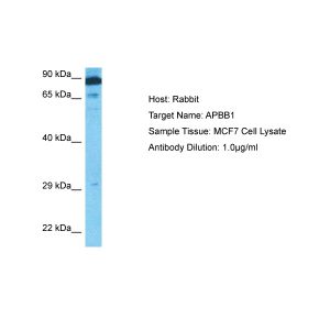 Human MCF7 Whole Cell
