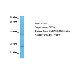 Human OVCAR-3 Whole Cell