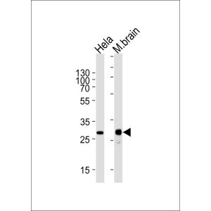 Hela cell line and mouse brain tissue lysate (from left to right)