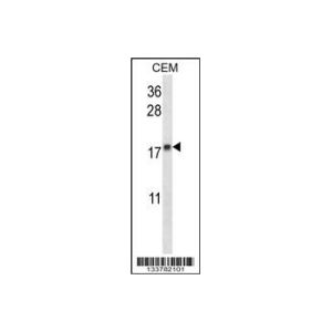 CEM 