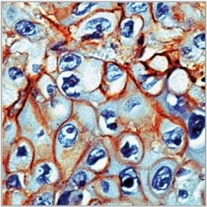 Human Placenta