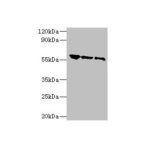 Rabies virus antigen 1, 2, Rabies virus antigen 1, 10, Rabies virus antigen 1, 20