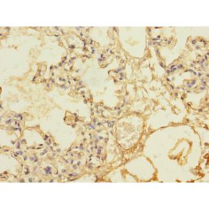 Human lung tissue 