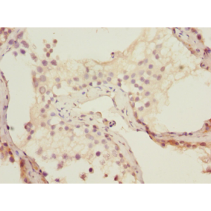 Human Testis