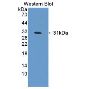 Protein Lrrc32