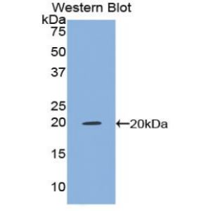 Tumor necrosis factor
