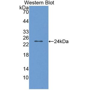 Transient receptor potential cation channel subfamily V member 1