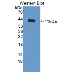 Protein farnesyltransferase/geranylgeranyltransferase type-1 subunit alpha