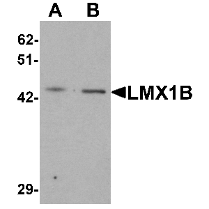 A-20 cell lysate