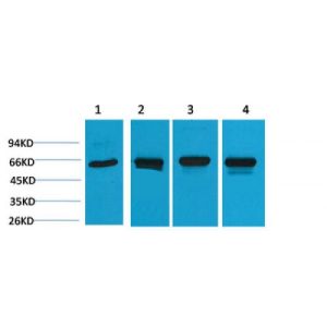 Western Blot