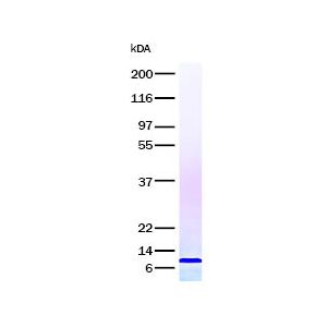 Interleukin-8 SDS-PAGE