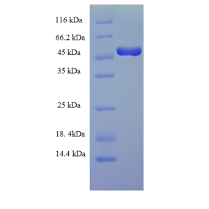 Protein SDS-PAGE