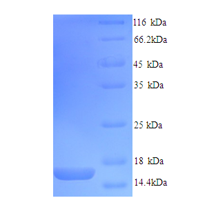 Protein SDS-PAGE