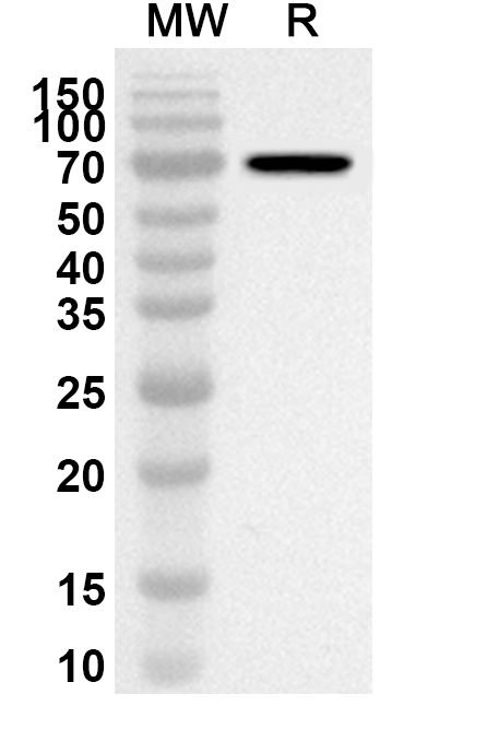 Anti-EV71 Protease 3C Polyclonal Antibody binds to Recombinant EV71 Protease 3C, C-His in WB Assay