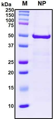 Recombinant SARS-CoV-2 Nucleocapsid Protein
