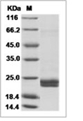 Interferon alpha 2/IFNA2 Protein, Mouse, Recombinant