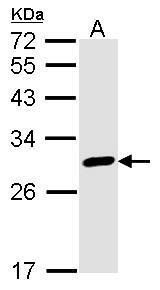 Sample (30 ug of whole cell lysate). A: A431. 12% SDS PAGE. Calretinin antibody. TA308723 diluted at 1:1000.