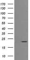 HEK293T cells were transfected with the pCMV6-ENTRY control (Cat# <a href = "https://www.origene.com/catalog/vectors/mammalian-expression-vectors/ps100001-pcmv6-entry-mammalian-expression-vector" title="PS100001" class="">PS100001</a>, Left lane) or pCMV6-ENTRY CD3E (Cat# <a href = "https://www.origene.com/catalog/cdna-clones/expression-plasmids/rc208276-cd3e-nm-000733-human-tagged-orf-clone" title="RC208276" class="">RC208276</a>, Right lane) cDNA for 48 hrs and lysed. Equivalent amounts of cell lysates (5 ug per lane) were separated by SDS-PAGE and immunoblotted with anti-CD3E(Cat# TA506064). Positive lysates <a href = "https://www.origene.com/catalog/proteins/over-expression-lysates/ly400242-cd3e-nm-000733-human-over-expression-lysate" title="LY400242" class="">LY400242</a> (100ug) and <a href = "https://www.origene.com/catalog/proteins/over-expression-lysates/lc400242-cd3e-nm-000733-human-over-expression-lysate" title="LC400242" class="">LC400242</a> (20ug) can be purchased separately from OriGene.