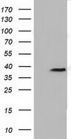 HEK293T cells were transfected with the pCMV6-ENTRY control (Left lane) or pCMV6-ENTRY FKBPL (<a href = "https://www.origene.com/catalog/cdna-clones/expression-plasmids/rc202153-fkbpl-nm-022110-human-tagged-orf-clone" title="RC202153" class="">RC202153</a>, Right lane) cDNA for 48 hrs and lysed. Equivalent amounts of cell lysates (5 ug per lane) were separated by SDS-PAGE and immunoblotted with anti-FKBPL. Positive lysates <a href = "https://www.origene.com/catalog/proteins/over-expression-lysates/ly411782-fkbpl-nm-022110-human-over-expression-lysate" title="LY411782" class="">LY411782</a> (100ug) and <a href = "https://www.origene.com/catalog/proteins/over-expression-lysates/lc411782-fkbpl-nm-022110-human-over-expression-lysate" title="LC411782" class="">LC411782</a> (20ug) can be purchased separately from OriGene.