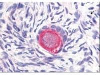 Affinity Purified anti-Delta-4 antibody was used at 20 ug/ml to detect Delta-4 in a variety of tissues including colon, liver, skeletal muscle, ovary, pancreas, prostate, testes, thymus, tonsil and uterus. In contrast to reported findings, no staining was observed in vascular tissue. This image shows Delta-4 staining of human ovary. Tissue was formalin-fixed and paraffin embedded. Personal Communication, Tina Roush, LifeSpanBiosciences, Seattle, WA.