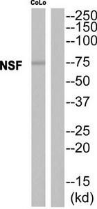 Western blot analysis of extracts from CoLo cells, using NSF antibody.The lane on the right is treated with the synthesized peptide.