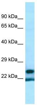 WB Suggested Anti-YRDC Antibody; Titration: 1.0 ug/ml; Positive Control: ACHN Whole Cell