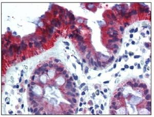 BM2275F KRT18 antibody staining of Formalin-Fixed, Paraffin-Embedded Human Colon followed by biotinylated anti-mouse IgG secondary antibody, alkaline phosphatase-streptavidin and chromogen.