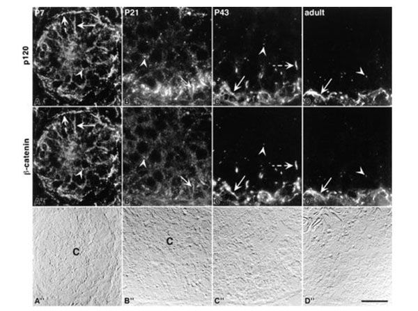 Colocalization of p120 and β-catenin using Anti-Mouse IgG1 FITC (p/n R1359F) during postnatal testis development. Here, the 8D11 antibody was used to immunostain for p120. In all locations, p120 and β-catenin showed exact colocalization. At Postnatal Day 7 (A), diffuse immunostaining outlined all cells of the developing epithelium (solid arrow). In addition, punctate structures (arrowhead) were observed throughout the tubule. At the tubule periphery, intense immunostaining was associated with peritubular cells (dashed arrows). From Day 21 through adulthood, p120 and β-catenin colocalized at basal inter-Sertoli junctions (arrows in B–D), and at punctate, spermatocyte-associated structures (arrowheads in B–D). In addition, extended, linear immunostaining at the level of spermatocytes was observed at Day 43 (C and C′; dashed arrows). Corresponding DIC images are shown in A′′, B′′, C′′, and D′′. The center (C) of Day 7 and Day 21 seminiferous tubules is indicated in the DIC images. In all images, the seminiferous tubule basement membrane is located at the bottom, and in C′′ and D′′, the entire seminiferous epithelium is shown. Bar = 20 μm. Fig 2. PMID: 11906917.