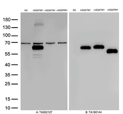 Figure A, Western blot analysis of overexpressed lysates (25ug per lane) from HEK293T cells transfected with empty plasmid (<a href = "https://www.origene.com/catalog/vectors/mammalian-expression-vectors/ps100001-pcmv6-entry-mammalian-expression-vector" title="PS100001" class="">PS100001</a>, NC) , human SQSTM1 plasmid (<a href = "https://www.origene.com/catalog/cdna-clones/expression-plasmids/rc203214-sqstm1-nm-003900-human-tagged-orf-clone" title="RC203214" class="">RC203214</a>, hSQSTM1), mouse SQSTM1 plasmid (<a href = "https://www.origene.com/catalog/cdna-clones/expression-plasmids/mr226105-sqstm1-nm-011018-mouse-tagged-orf-clone" title="MR226105" class="">MR226105</a>, mSQSTM1), mouse SQSTM1 plasmid (<a href = "https://www.origene.com/catalog/cdna-clones/expression-plasmids/mr206359-sqstm1-bc006019-mouse-tagged-orf-clone" title="MR206359" class="">MR206359</a>, mSQSTM1) using anti-SQSTM1 antibody TA502127 (1:500). Figure B, Western blot analysis of  the same samples as figure A with anti-DDK antibody (<a href = "https://www.origene.com/catalog/antibodies/tag-antibodies/ta180144-ddk-flag-mouse-monoclonal-antibody-clone-oti11c3" title="TA180144" class="">TA180144</a>, 1:1000)