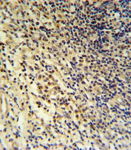 PLA2G7 Antibody (Center) (Cat. #AP9819c) IHC analysis in formalin fixed and paraffin embedded tonsil followed by peroxidase conjugation of the secondary antibody and DAB staining.  This data demonstrates the use of the PLA2G7 Antibody (Center) for immunohistochemistry.  Clinical relevance has not been evaluated.