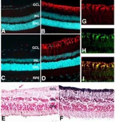 Immunohistochemistry: Glutamine Synthetase Antibody TA301447 - Localization of glutamine synthase in the retina. Paraffin sections of mouse (A, B), rat (C, D, G-I), or human (E, F) retina fixed in 4% paraformaldehyde were reacted with anti-glutamine synthase (red fluorescence staining in B, D, G, I, and brown immuno-peroxidase reaction. Nuclei in IF experiments (A-D) were stained with DAPI (cyan), and with nuclear fast red in E and F. At low magnification, anti-glutamine synthase reacted with a single population of cells extending from the ganglion cell layer through the inner nuclear layer. No signal was detected in controls either pre-incubated with 100ug/ml of the immunizing peptide (A) or with pre-immune serum (C, E). This finding was confirmed by co-localization (indicated by yellow in I) of glutamine synthase (red in G) with antoher marker of glutamine synthase (green in H).
