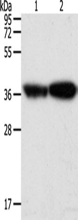 Gel: 12%SDS-PAGE<br>Lysate: 40 μg<br>Lane 1-2: Human leiomyosarcoma tissue<br>mouse testis tissue<br>Primary antibody: TA322875 (TPM2 Antibody) at dilution 1/1000<br>Secondary antibody: Goat anti rabbit IgG at 1/8000 dilution<br>Exposure time: 1 second