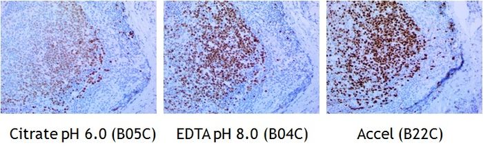 IHC staining of FFPE human tonsil tissue within normal limits using mouse anti-human Ki67 monoclonal antibody and Polink-1 HRP Broad for DAB D11-18. Heat-induced epitope retrieval by Citrate Buffer pH 6.0 (Cat. No.: B05C-100), EDTA Solution pH 8.0 (Cat. No.: <a href = "https://www.origene.com/catalog/assay-kits/ihc-kits-and-reagents/b04c-100-edta-buffer-solution-20x" title="B04C-100" class="">B04C-100</a>), and Accel Retrieval Solution (B22C-125) (15-20 minutes at 95 C-100 C). The brown stain indicates positive stain and blue is the counter stain. It is mounted using a permanent Organic mounting medium E37-100.