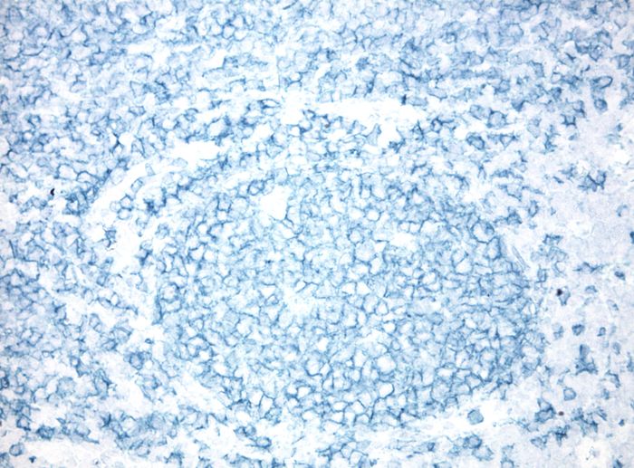 Human tonsil stained with with OriGene Mouse anti MS4A1 (<a href = "https://www.origene.com/catalog/antibodies/primary-antibodies/um800009-cd20-ms4a1-mouse-monoclonal-antibody-clone-id-umab58" title="UM800009" class="">UM800009</a> diluted 1:600) seen as the emerald membrane stain  HIER buffer TEE (B21C-100) was used 10 minutes pressure cooker. Secondary Polink1 HRP anti-Ms (D12-18),  emerald chromogen (C12-18)  is ready to use and place on tissue for 5 to 10 minutes