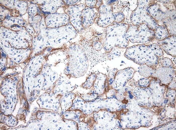 Human placenta with OriGene Mouse anti-PD-L1 (UM800120 dilution 1:100) using Polink1 (D12-110) mouse polymer detection and HIER TEE buffer pH9 for was used 10 minutes pressure cooker. Primary antibody was incubated 1 hour; Polink-1 (D12-110) for 15 minutes and chromogen for 5 minutes according to protocol data sheet.