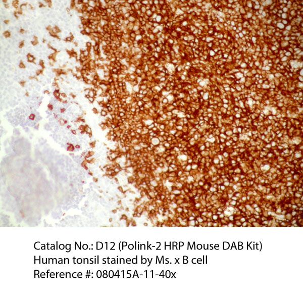 Polink-1 HRP Mouse DAB Detection Kit